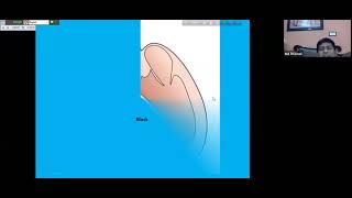 Session03 RBBBLBBB ST change Twave Abnormality Electrolytes amp ECG by DrMdShahidullah Shamol [upl. by Anaela]