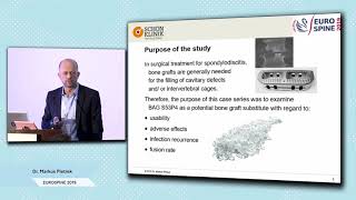 Eurospine 2019  Dr Markus Pietrek  Spondylodiscitis [upl. by Erehc]