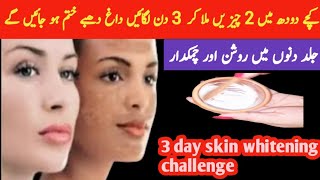 1 Day Challenge Raw Milk Face Pack For Skin Whitening Remove Pigmentation Glowing Skin fairness [upl. by Aldo]