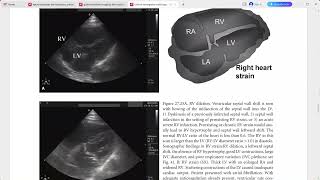 CLINICAL EMERGENCY RADIOLOGY CAMBRIDGE [upl. by Maxantia]