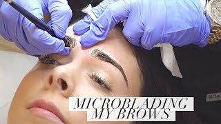 Microblading My Eyebrows [upl. by Johnson178]