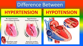 Difference between Hypertension and Hypotension [upl. by Tdnerb962]