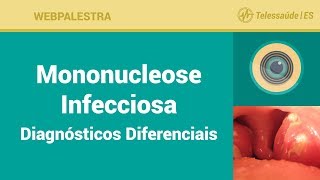 WebPalestra Mononucleose Infecciosa Diagnósticos Diferenciais [upl. by Nwahsan]