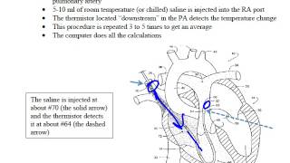 Thermodilution CO [upl. by Gerek]