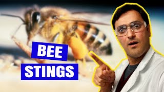 How to Treat BEE STINGS At Home [upl. by Thurman970]