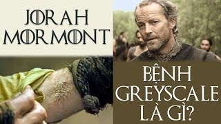 Game of Thrones  JORAH MORMONT MẮC BỆNH GÌ VÀ CÓ CHỮA ĐƯỢC KHÔNG [upl. by Ahseined733]