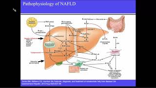 NAFLDNASH Present amp Future Management Options [upl. by Imis914]