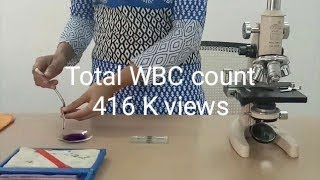 TOTAL WBC COUNT [upl. by Yauqram]