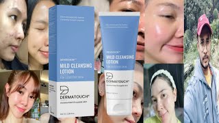 Dermatouch Mild Cleansing Lotion  Honest Review [upl. by Anehs668]