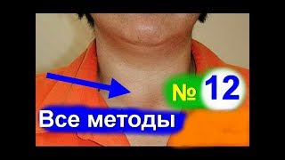 Щитовидная железа ГИПОТИРЕОЗ симптомы о которых вы не знали Причины и лечение Гипотиреоза [upl. by Ueihtam496]