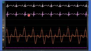 Hemodinamia Valores normales vistas y proyecciones [upl. by Hoj]