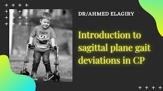 Introduction to sagittal plane deviations of gait in CP [upl. by Kessel]