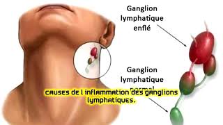 Causes de l’inflammation des ganglions lymphatiques [upl. by Ellehcin]