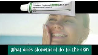 What does clobetasol do to the skin [upl. by Anelaf]