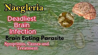 Brain Eating Naegleria Infection Symptoms Causes and Treatments [upl. by Llesirg282]