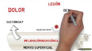 Que es la Neuroproloterapia  PSI [upl. by Ecniuq]