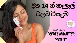 කැලැල් නැතිකරන Lighting glowing cream  Before and after results  Eventone C crem  100 recommend [upl. by Shoshanna]