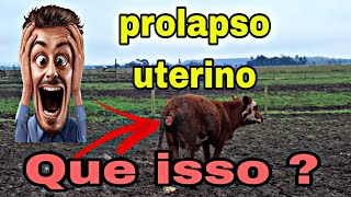 prolapso uterino [upl. by Liw]