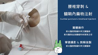 腰椎穿刺 amp 髓鞘內藥物注射 Lumbar puncture amp Intrathecal injection 腰椎穿刺 amp 硬膜外薬剤注入 新光醫院血液腫瘤科 林瑛珠主任 4K60p [upl. by Nester]