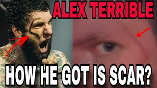 Slaughter to Prevail Alex Terrible reveals how he got his face scar [upl. by Keiryt]