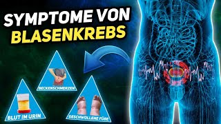 7 Symptome von Blasenkrebs die jeder kennen sollte [upl. by Eldnik264]