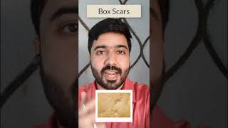 2 Types of Acne Scars SkinCare Shorts [upl. by Dhaf994]