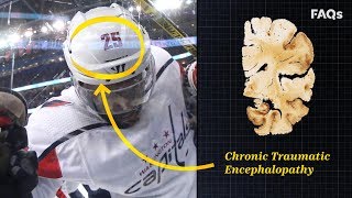 CTE Why this brain disease is more common than you think [upl. by Solracnauj]