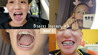 accidentally ATE my elastics lol 🦷BRACES🦷 [upl. by Nnylodnewg]