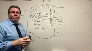 Nearsightedness Farsightedness and Normal Vision Explained so you can understand [upl. by Adda]