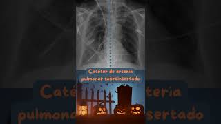 Identificación en la Radiografía de Tórax de elementos de uso común en la UCI radiografía uci icu [upl. by Valente194]