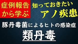 症例報告から学ぶ 豚丹毒菌によるヒトの感染症 類丹毒 知っておきたいアノ疾患 [upl. by Akeme294]