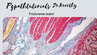 Masson trichrome stain [upl. by Celestyn]