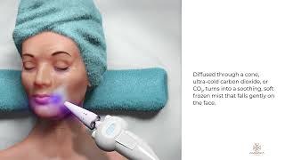 Frotox  cryo facial  with America Cryo Subzero device explained [upl. by Julieta]