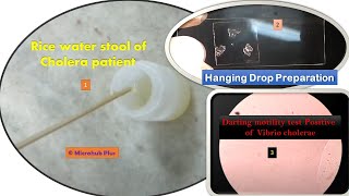 Darting motility test Positive of Vibrio cholerae and Rice water stool of Cholera patient Demonstrat [upl. by Simara]