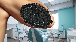 ASMR nerve for sleep biology trypophobia Many cleaning Elbow ASMR animation satisfying [upl. by Bolten485]