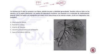 SIMULACRO 33 PARTE B [upl. by Hobard]