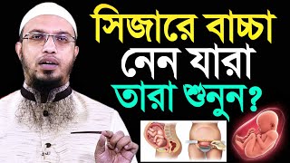 মহিলাদের সিজারে বাচ্চা হলে কি হয় অধিকাংশ মানুষ জানেই না শায়খ আহমাদুল্লাহ [upl. by Gascony]