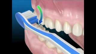 Tecniche di igiene orale Uso corretto dello spazzolino da denti [upl. by Tullus238]