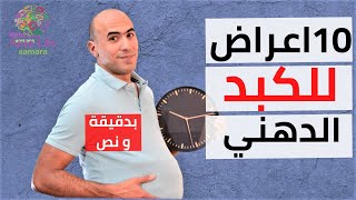 أعراض الكبد الدهني بدقيقة و نص 07 [upl. by East893]