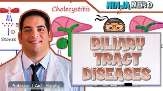 Biliary Tract Diseases  Clinical Medicine [upl. by Dorcas351]