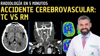 Radiología en 5 minutos Accidente cerebrovascular Tomografía computarizada vs Resonancia magnética [upl. by Elgna866]