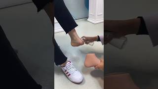 Silicone Foot Prosthesis Fit😲 Silicone Foot ProsthesisFit Luxmed ProstheticLimb [upl. by Yar]