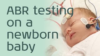 ABR Testing a newborn baby [upl. by Shantha]