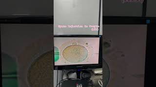 Embryo Transfer Procedure Explain by Dr Faizan Ahmad embryotransfer ivfsuccess [upl. by Adnolahs531]