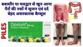 Doxium 500mg capsule। Calcium dobesilate। बबासीर व मलद्वार से खून आना पैरों की नसों मे सूजन एवं दर्द [upl. by Ecam386]