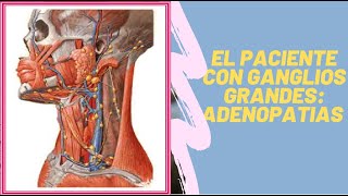 EL PACIENTE CON GANGLIO GRANDES ADENOPATIAS [upl. by Akkinahs]