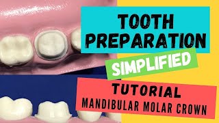 Zirconia Crown Preparation DEMONSTRATION Super Simplified [upl. by Ecinert]