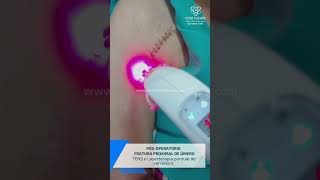 Pósoperatório de Fratura proximal se úmero  Tens  Laserterapia varredura e pontual [upl. by Ennaeus586]