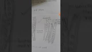 tls and rls of stem of Gnetum [upl. by Noorah]