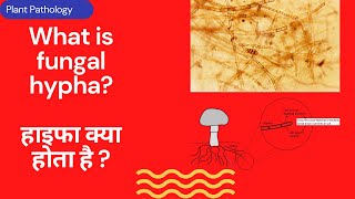 whats is hyphae in fungi Fungal hypha saptate and coenocytic hyphae mycelium of fungi Biology NEET [upl. by Atikam961]